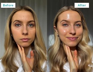 Images showing young woman's skin results before and after using Curél Intensive Moisture Facial Cream